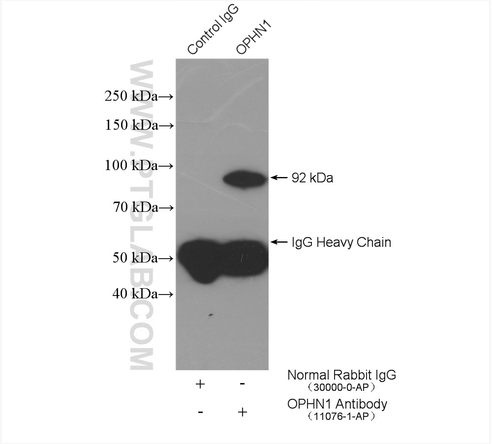 Immunoprecipitation (IP) experiment of mouse brain tissue using Oligophrenin 1 Polyclonal antibody (11076-1-AP)