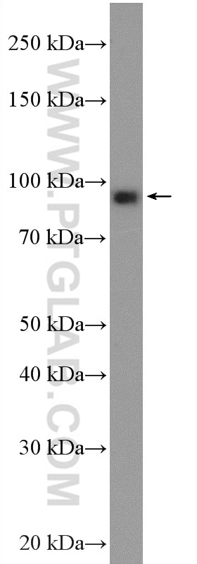 Western Blot (WB) analysis of HeLa cells using Oligophrenin 1 Polyclonal antibody (11076-1-AP)
