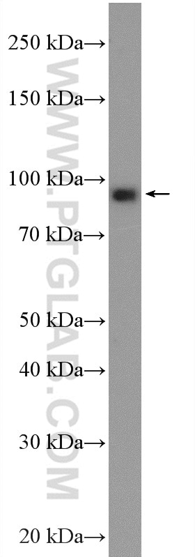 WB analysis of HeLa using 11076-1-AP