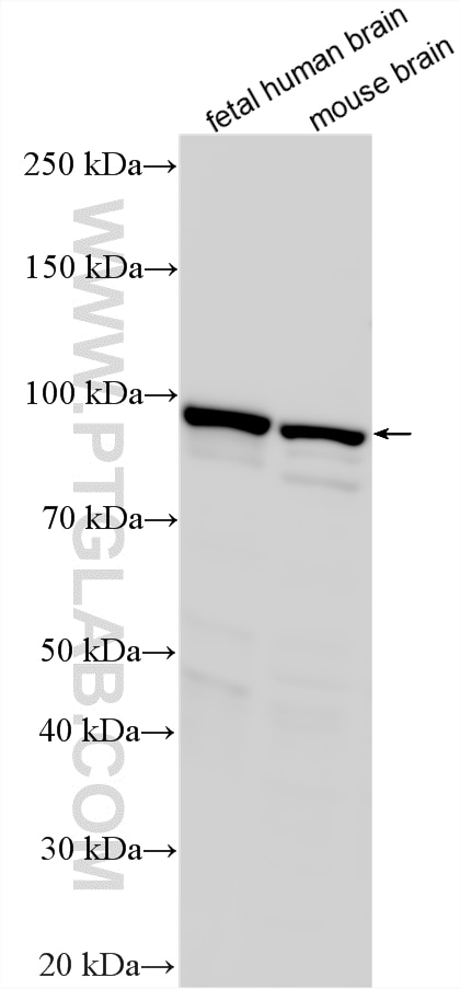 WB analysis using 11076-1-AP Western Blot (WB) analysis of various lysates using Oligophrenin 1 Polyclonal antibody (11076-1-AP)
