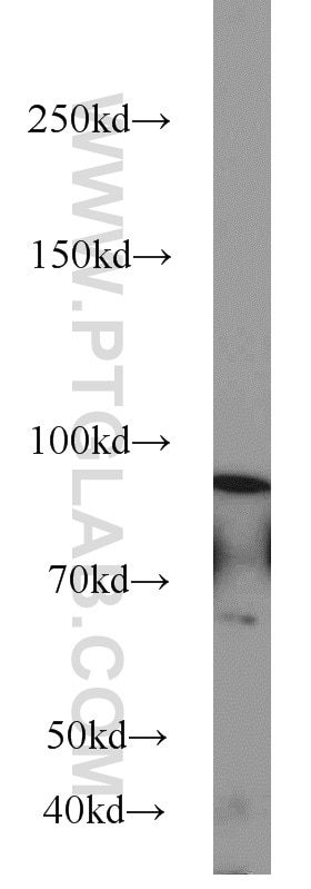 Western Blot (WB) analysis of mouse brain tissue using Oligophrenin 1 Polyclonal antibody (11076-1-AP)