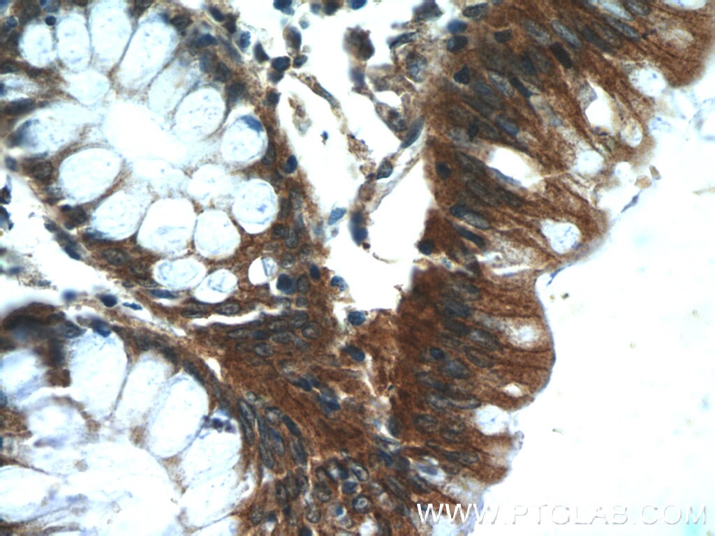 Immunohistochemistry (IHC) staining of human colon tissue using Oligophrenin 1 Polyclonal antibody (17445-1-AP)