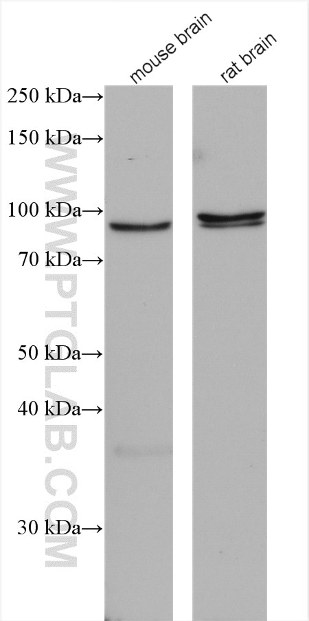 Western Blot (WB) analysis of various lysates using Oligophrenin 1 Polyclonal antibody (17445-1-AP)