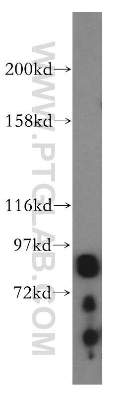 Oligophrenin 1