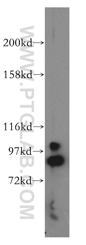 Western Blot (WB) analysis of mouse skeletal muscle tissue using Oligophrenin 1 Polyclonal antibody (17445-1-AP)