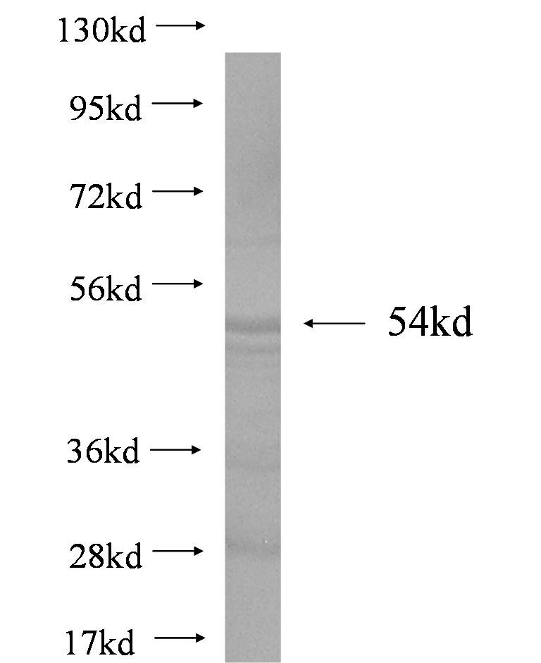 OPHN1 fusion protein Ag1536 SDS-PAGE