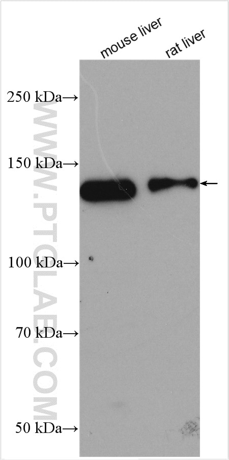 Western Blot (WB) analysis of various lysates using OPLAH Polyclonal antibody (21127-1-AP)