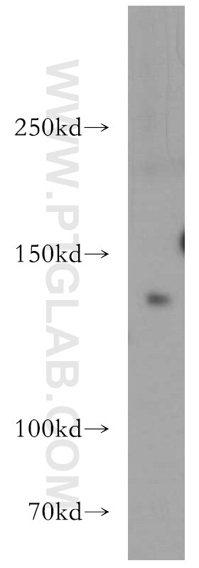 Western Blot (WB) analysis of mouse brain tissue using OPLAH Polyclonal antibody (21127-1-AP)