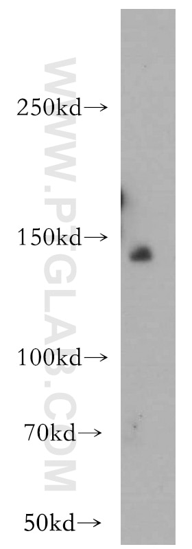 Western Blot (WB) analysis of L02 cells using OPLAH Polyclonal antibody (21127-1-AP)