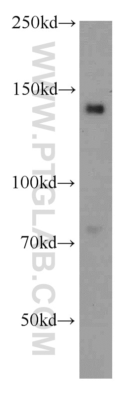 Western Blot (WB) analysis of mouse bladder tissue using OPLAH Polyclonal antibody (21127-1-AP)