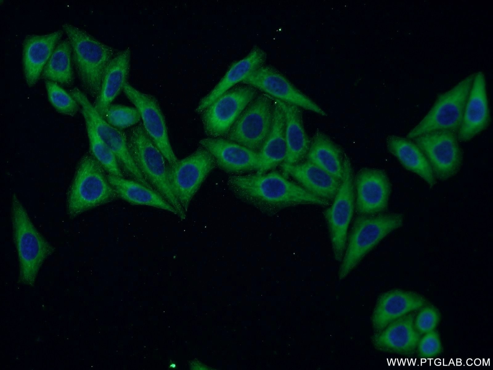 Immunofluorescence (IF) / fluorescent staining of HepG2 cells using Osteopontin Polyclonal antibody (22952-1-AP)