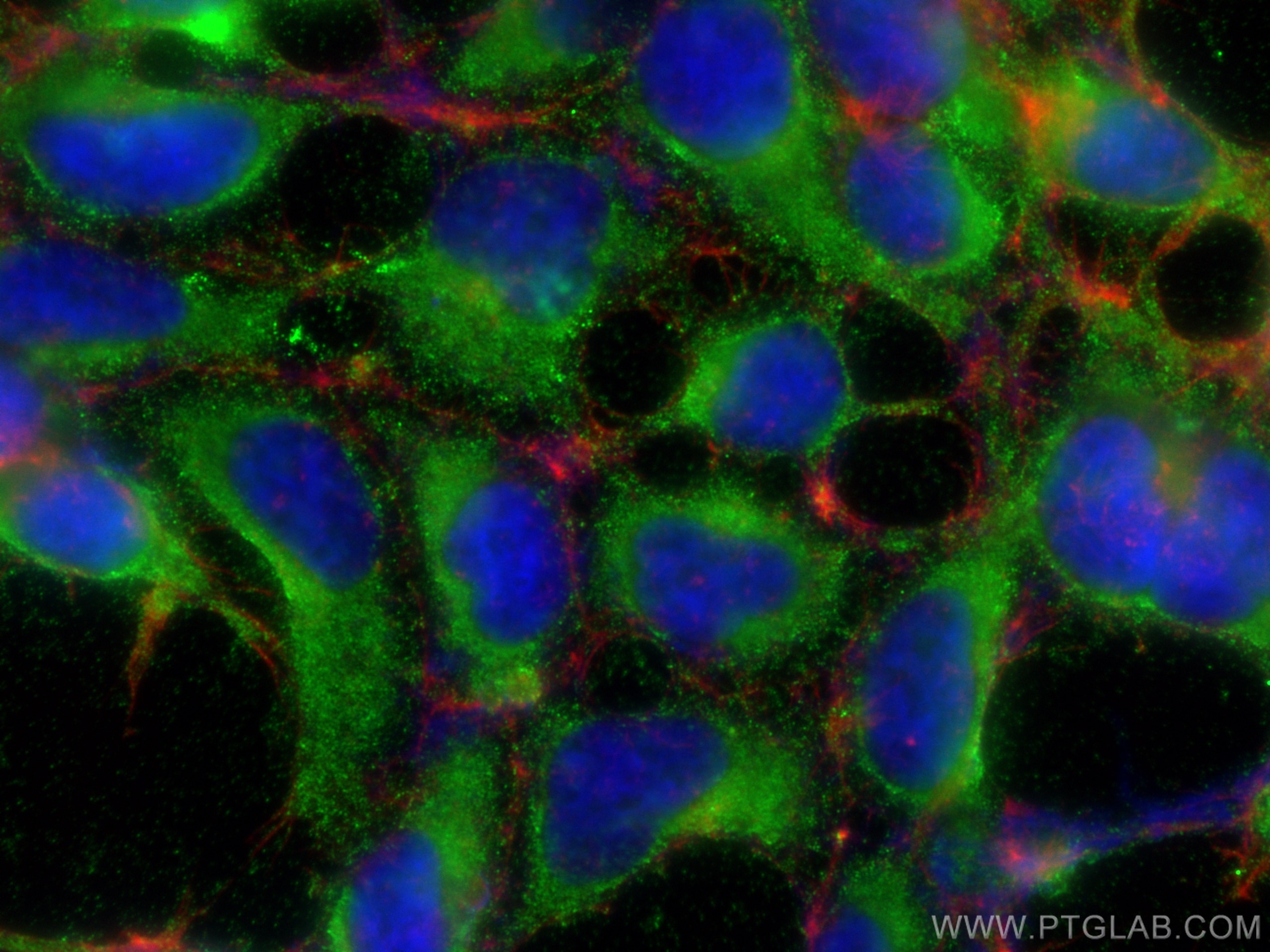 Immunofluorescence (IF) / fluorescent staining of HEK-293 cells using Osteopontin Polyclonal antibody (22952-1-AP)