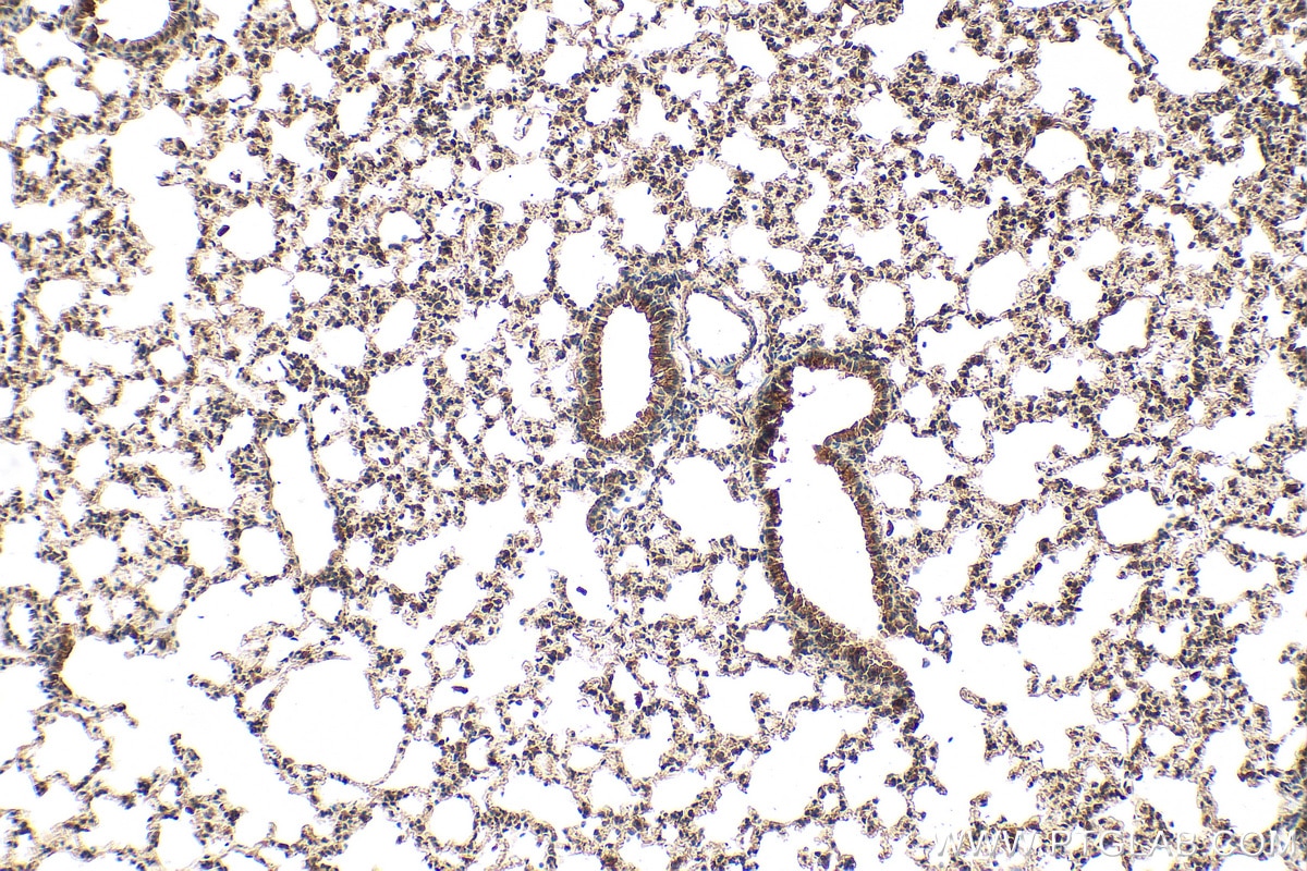 Immunohistochemistry (IHC) staining of mouse lung tissue using Osteopontin Polyclonal antibody (22952-1-AP)