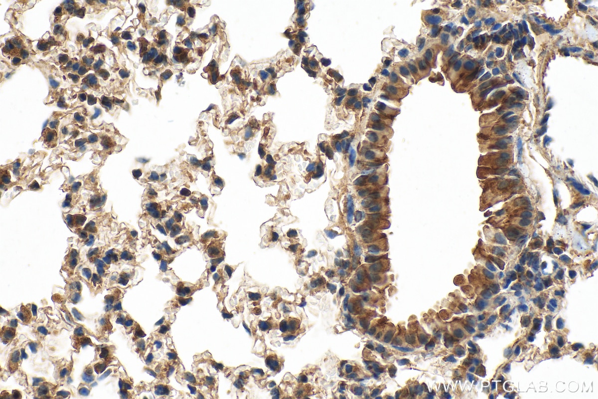 Immunohistochemistry (IHC) staining of mouse lung tissue using Osteopontin Polyclonal antibody (22952-1-AP)