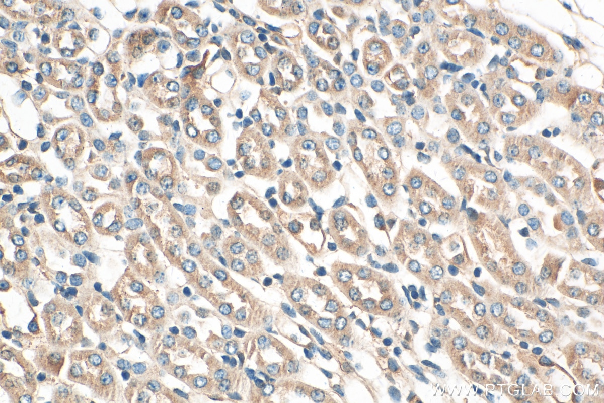 Immunohistochemistry (IHC) staining of mouse kidney tissue using Osteopontin Polyclonal antibody (22952-1-AP)
