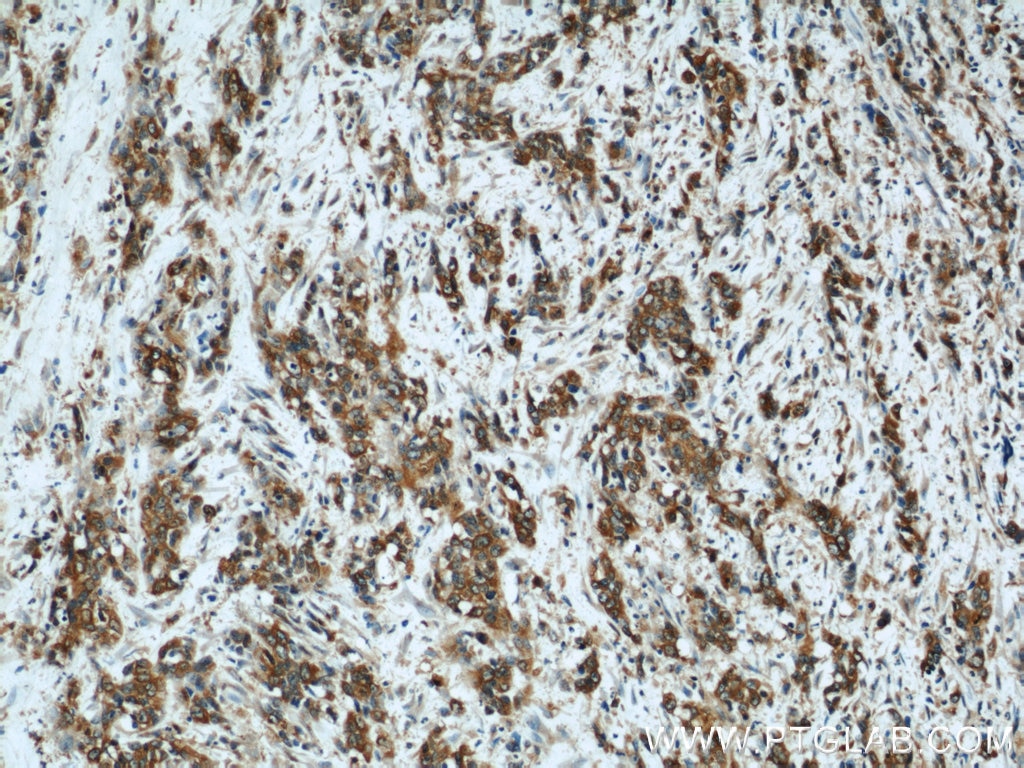 Osteopontin Polyclonal antibody