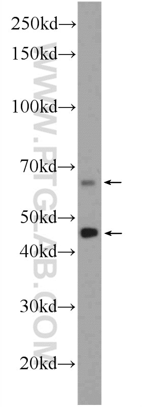 Western Blot (WB) analysis of Jurkat cells using Osteopontin Polyclonal antibody (22952-1-AP)