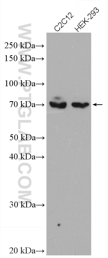 Western Blot (WB) analysis of various lysates using Osteopontin Polyclonal antibody (22952-1-AP)