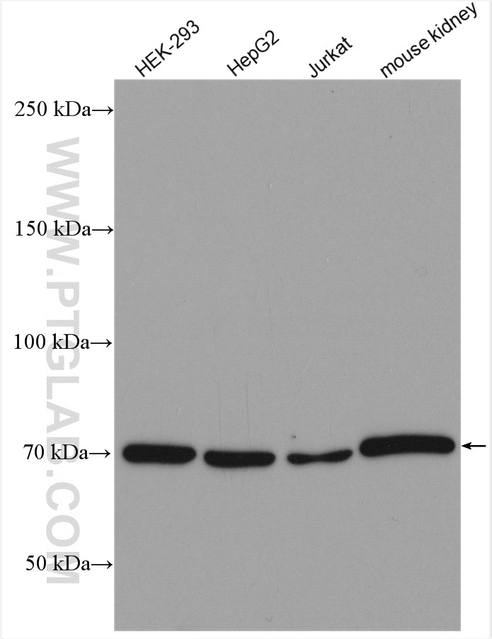 Western Blot (WB) analysis of various lysates using Osteopontin Polyclonal antibody (22952-1-AP)