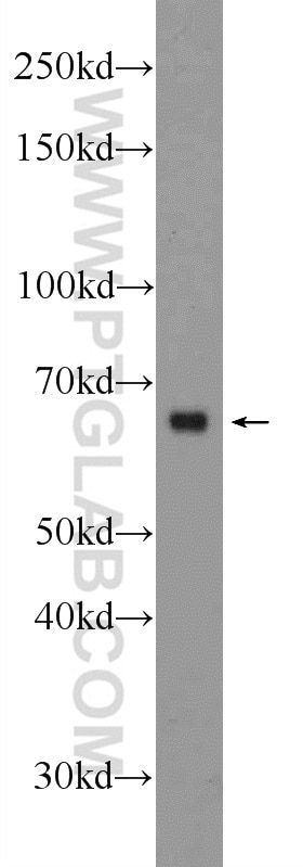 Osteopontin Polyclonal antibody