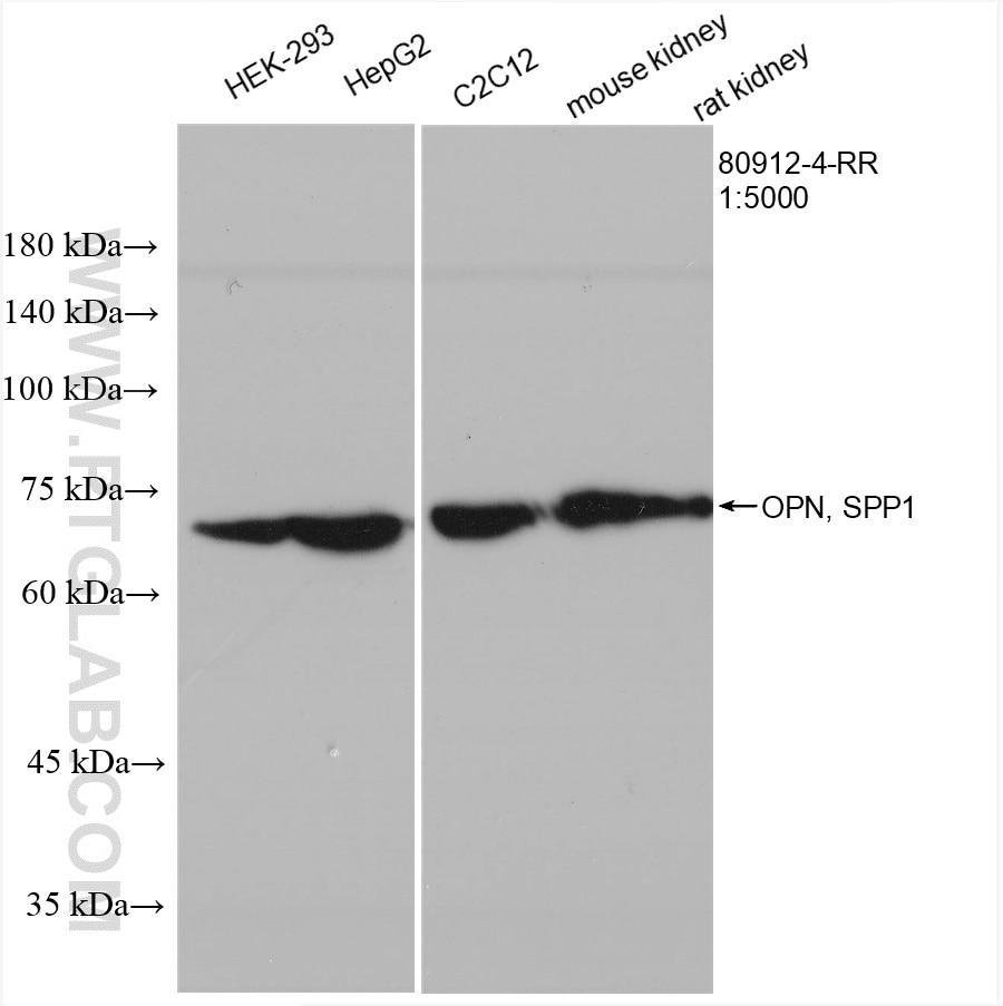 Western Blot (WB) analysis of various lysates using OPN, SPP1 Recombinant antibody (80912-4-RR)