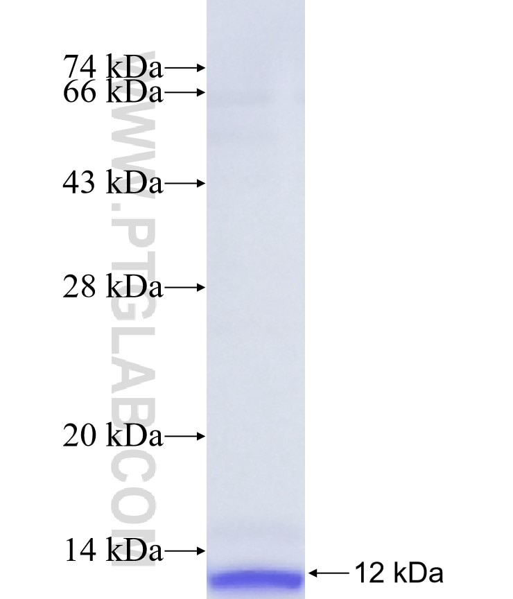 OPN1LW fusion protein Ag37886 SDS-PAGE OPN1LW fusion protein Ag37886 SDS-PAGE