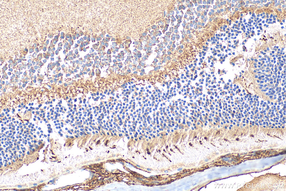 Immunohistochemistry (IHC) staining of mouse eye tissue using OPN1SW Polyclonal antibody (24660-1-AP)