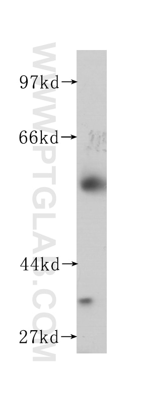 Western Blot (WB) analysis of mouse brain tissue using OPN3 Monoclonal antibody (60090-1-Ig)