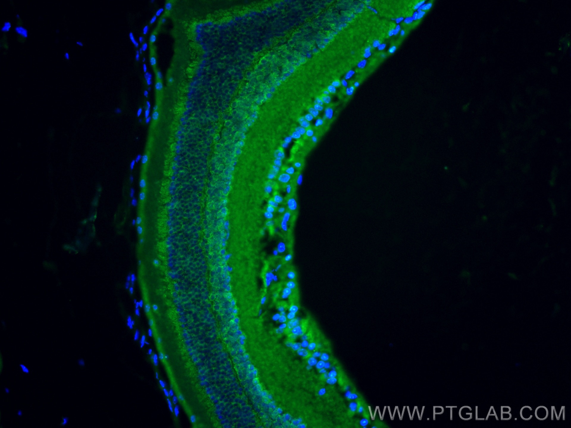Immunofluorescence (IF) / fluorescent staining of mouse eye tissue using OPN4 Polyclonal antibody (24478-1-AP)