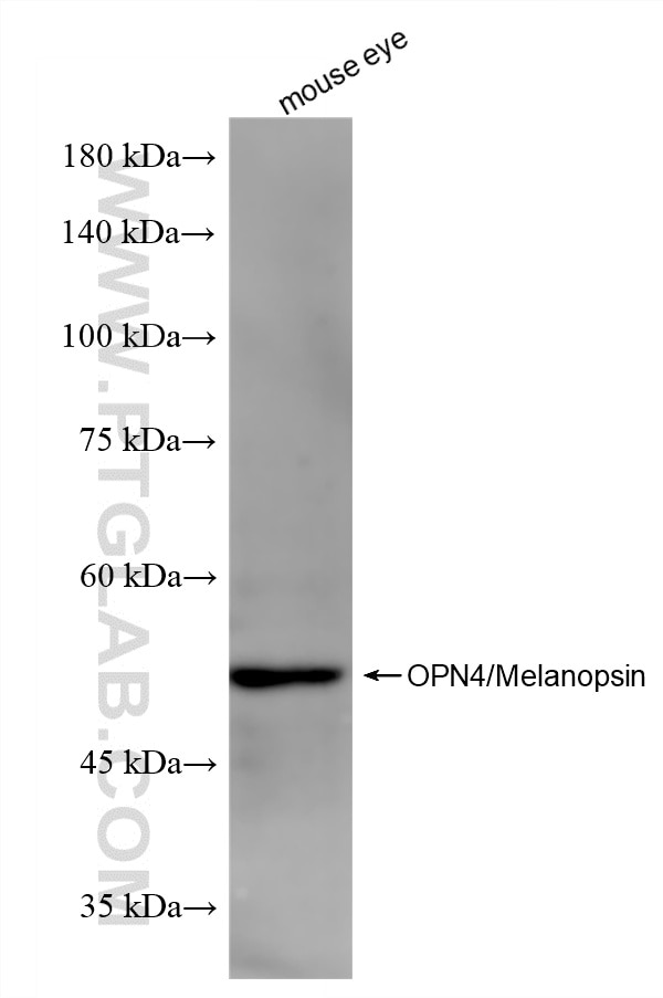 Western Blot (WB) analysis of mouse eye tissue using OPN4 Recombinant monoclonal antibody (87397-1-RR)