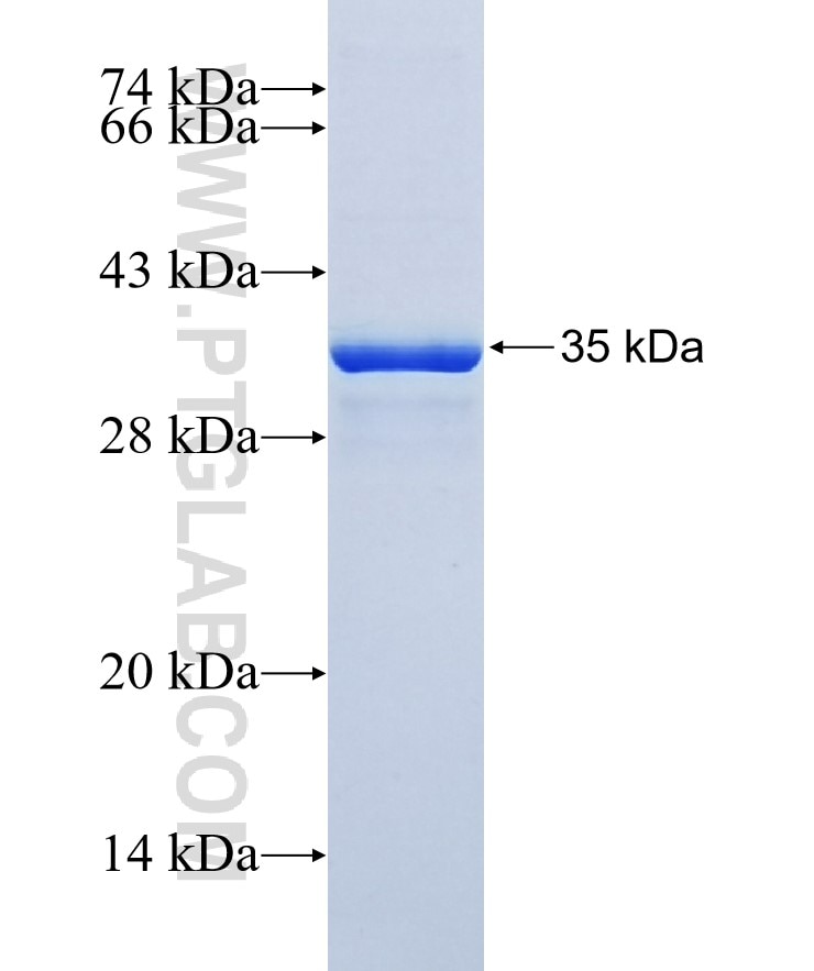OPRK1 fusion protein Ag37599 SDS-PAGE OPRK1 fusion protein Ag37599 SDS-PAGE