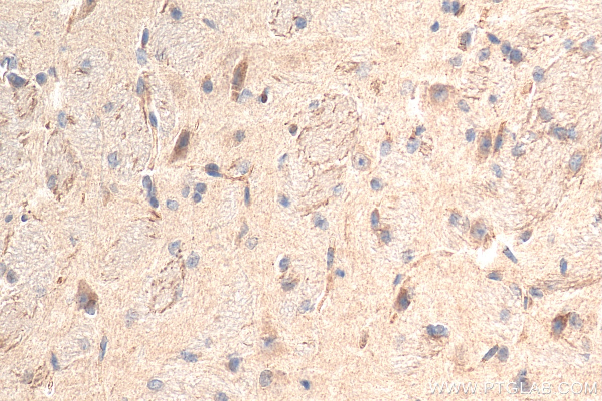 Immunohistochemistry (IHC) staining of mouse brain tissue using OPRL1 Polyclonal antibody (12970-1-AP)