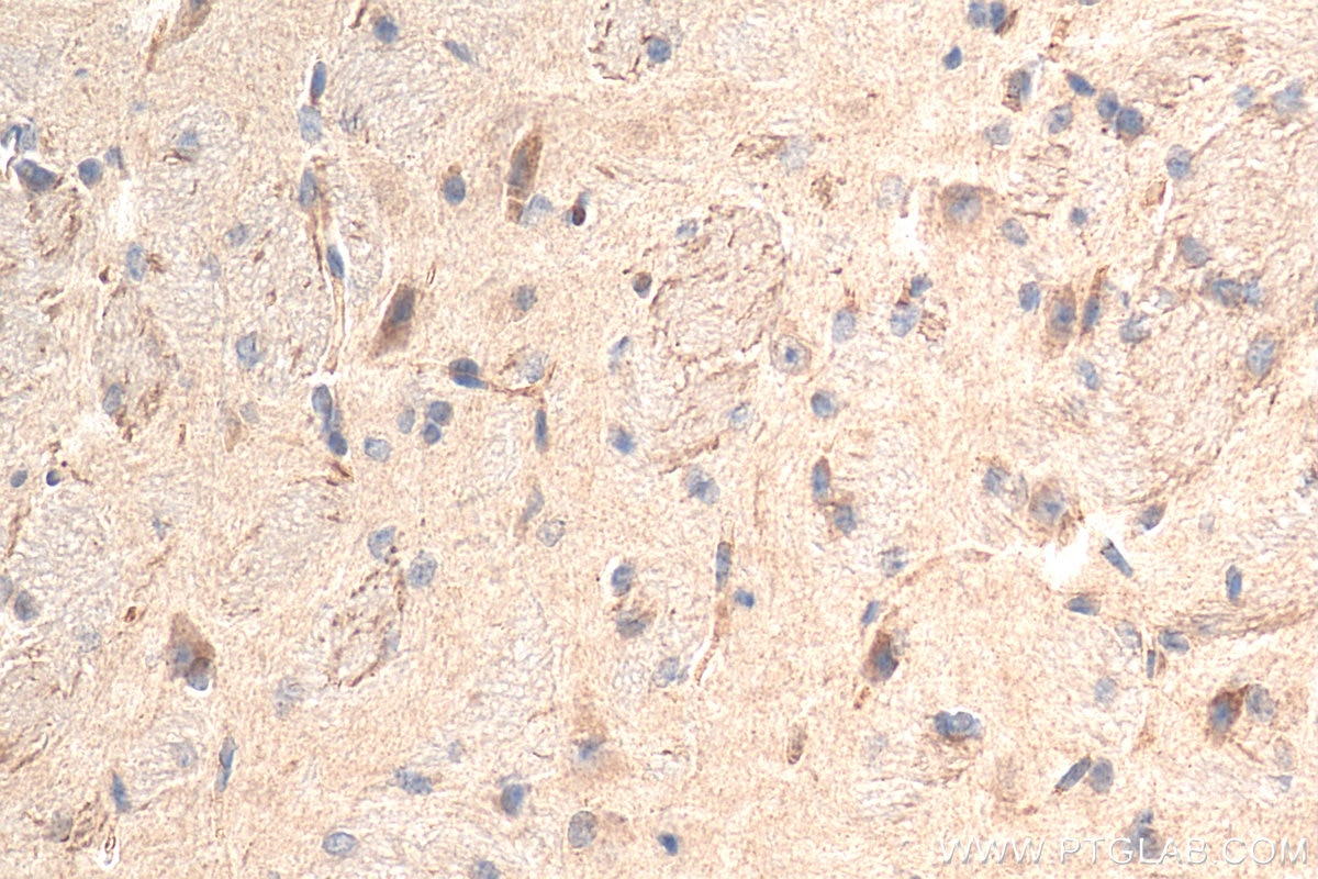 Immunohistochemistry (IHC) staining of mouse brain tissue using OPRL1 Polyclonal antibody (12970-1-AP)