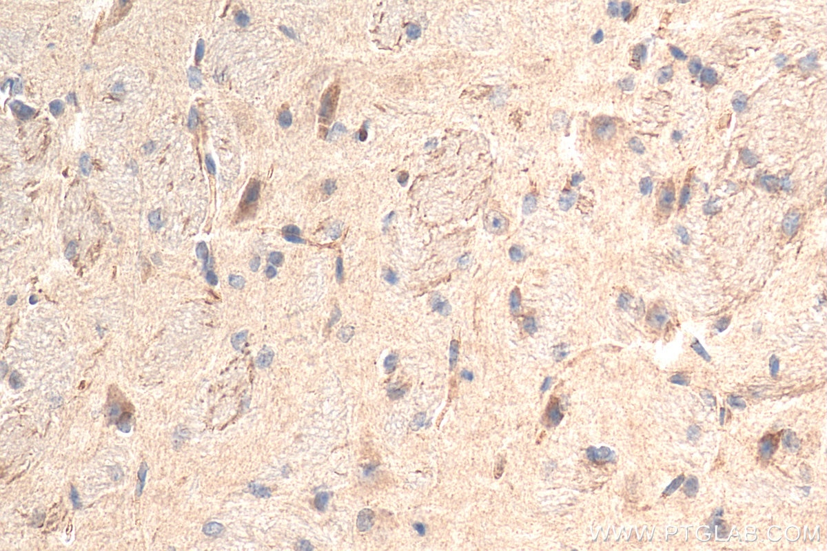 IHC staining of mouse brain using 12970-1-AP