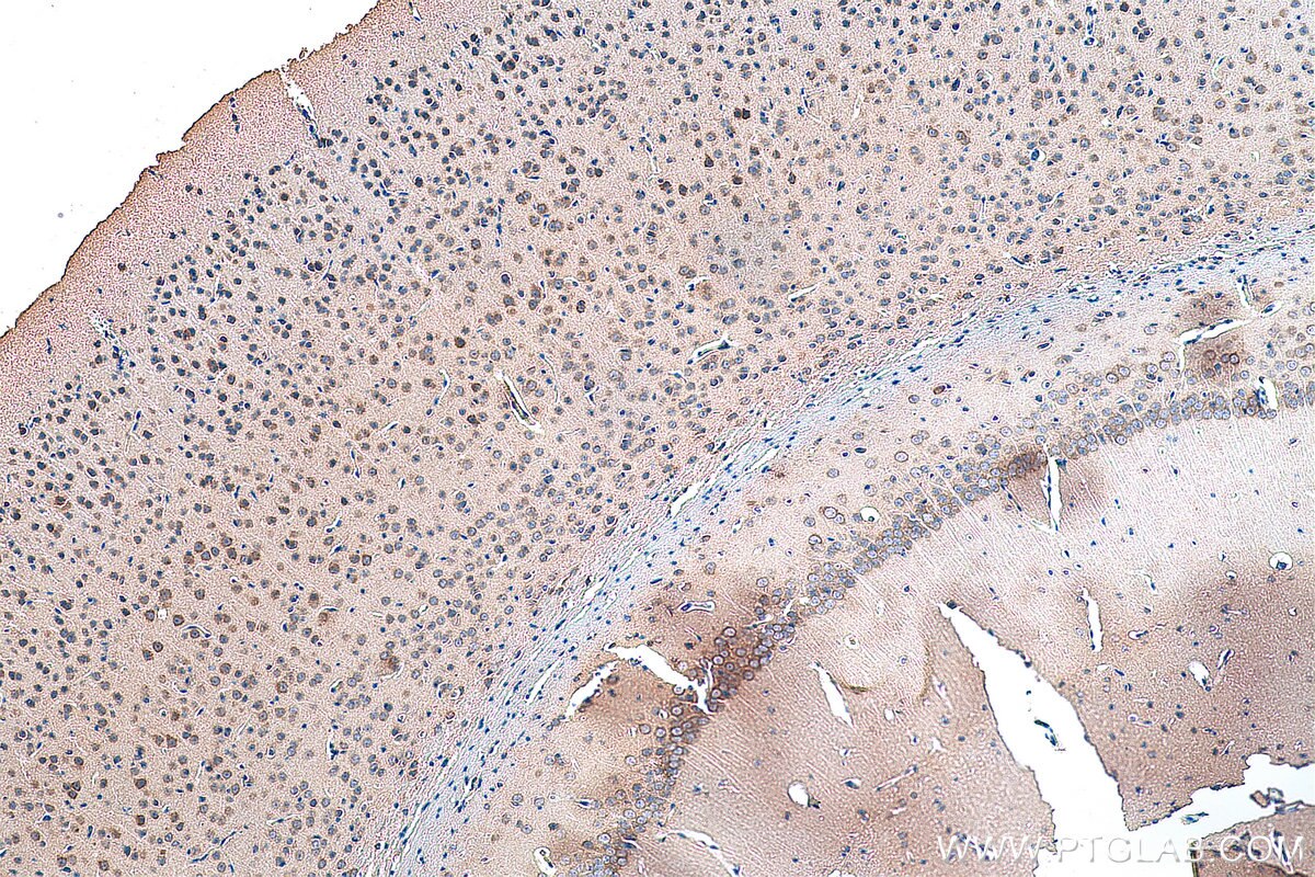 Immunohistochemistry (IHC) staining of mouse brain tissue using OPRM1 Polyclonal antibody (27625-1-AP)