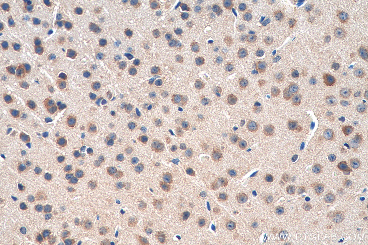 Immunohistochemistry (IHC) staining of mouse brain tissue using OPRM1 Polyclonal antibody (27625-1-AP)