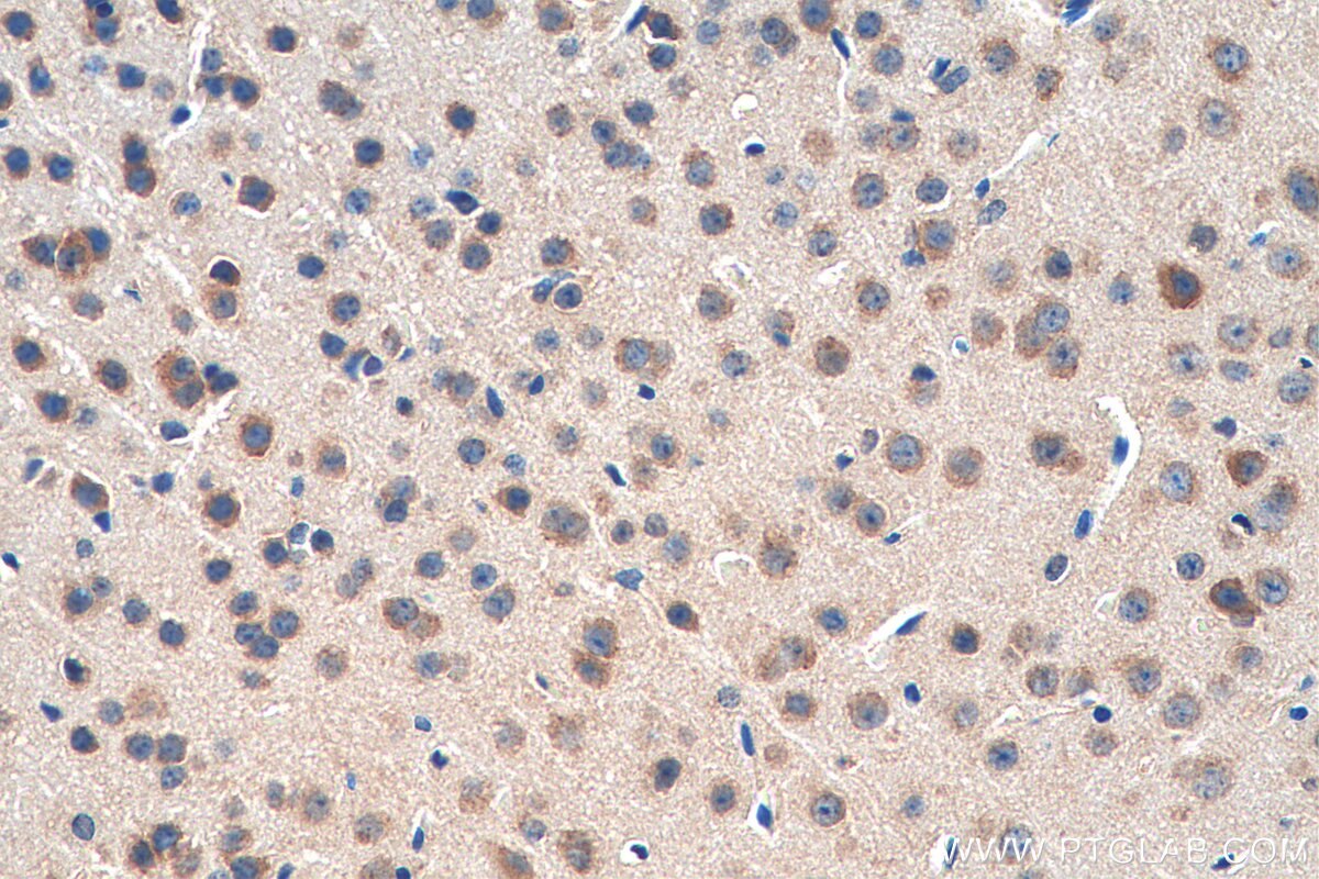 Immunohistochemistry (IHC) staining of mouse brain tissue using OPRM1 Polyclonal antibody (27625-1-AP)