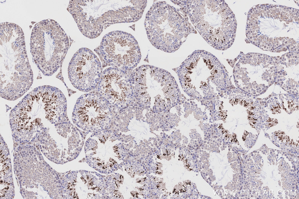 IHC staining of mouse testis using 27625-1-AP Immunohistochemistry (IHC) staining of mouse testis tissue using OPRM1 Polyclonal antibody (27625-1-AP)