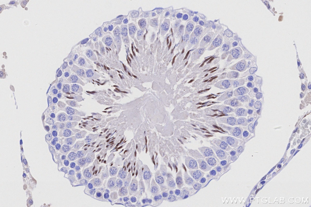 IHC staining of rat testis using 27625-1-AP Immunohistochemistry (IHC) staining of rat testis tissue using OPRM1 Polyclonal antibody (27625-1-AP)