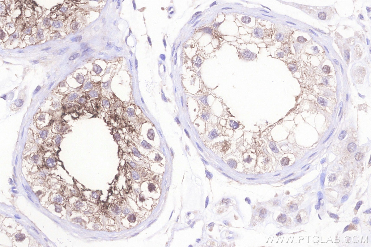 IHC staining of human testis using 27625-1-AP Immunohistochemistry (IHC) staining of human testis tissue using OPRM1 Polyclonal antibody (27625-1-AP)
