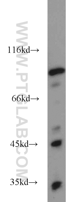 Western Blot (WB) analysis of mouse brain tissue using Opticin Polyclonal antibody (17897-1-AP)