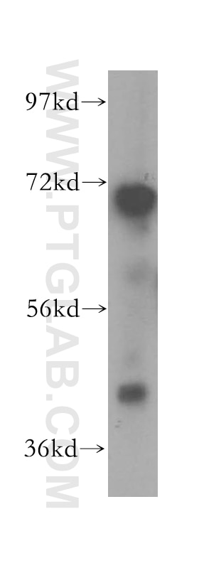 Western Blot (WB) analysis of mouse cerebellum tissue using Opticin Polyclonal antibody (17897-1-AP)