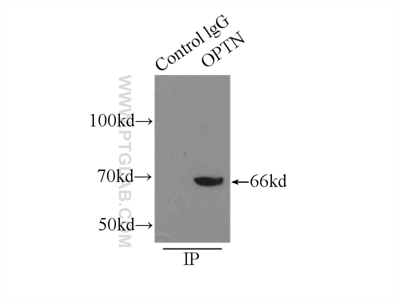 Immunoprecipitation (IP) experiment of mouse brain tissue using OPTN Polyclonal antibody (10837-1-AP)
