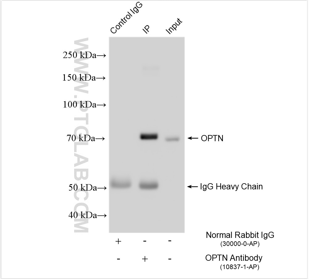 Immunoprecipitation (IP) experiment of HeLa cells using OPTN/Optineurin Polyclonal antibody (10837-1-AP)