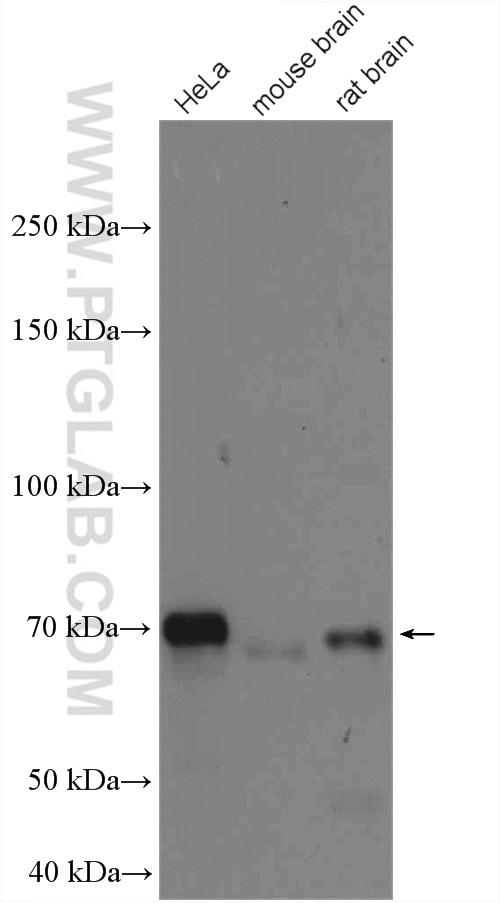 Western Blot (WB) analysis of various lysates using OPTN Polyclonal antibody (10837-1-AP)