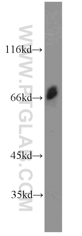 Western Blot (WB) analysis of mouse testis tissue using OPTN Polyclonal antibody (10837-1-AP)