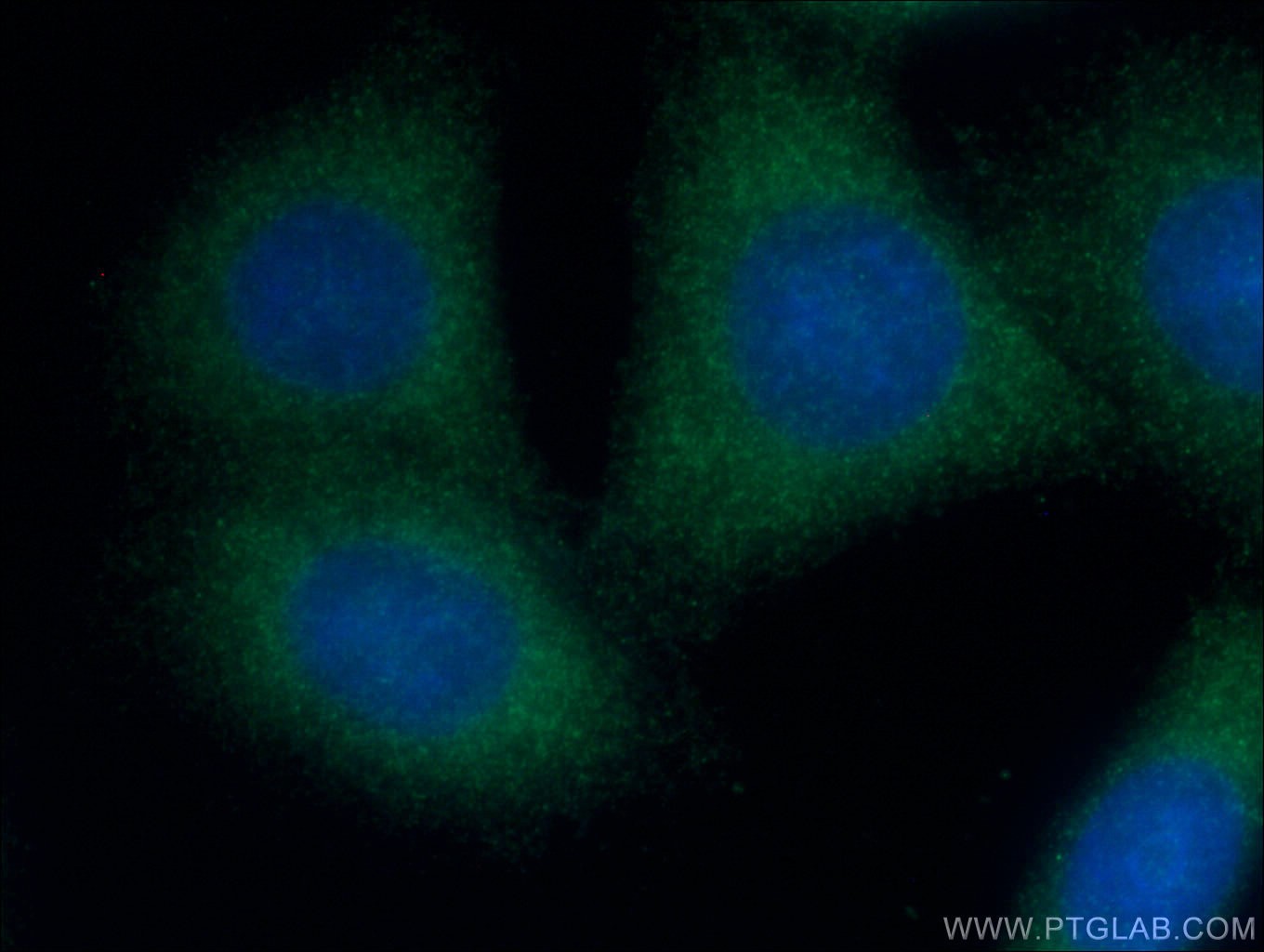 Immunofluorescence (IF) / fluorescent staining of HepG2 cells using OPTN Monoclonal antibody (60293-1-Ig)