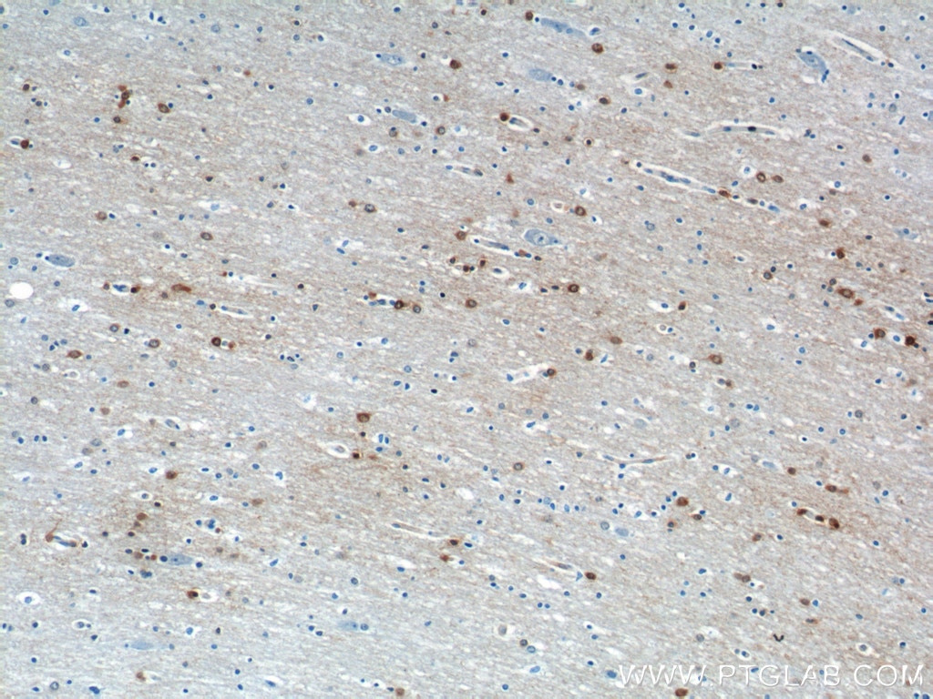 Immunohistochemistry (IHC) staining of human brain tissue using OPTN Monoclonal antibody (60293-1-Ig)