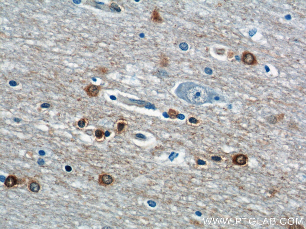Immunohistochemistry (IHC) staining of human brain tissue using OPTN Monoclonal antibody (60293-1-Ig)