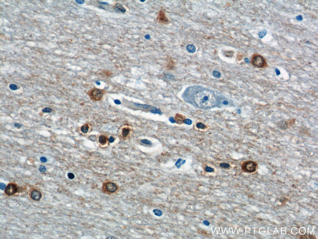 IHC staining of human brain using 60293-1-Ig